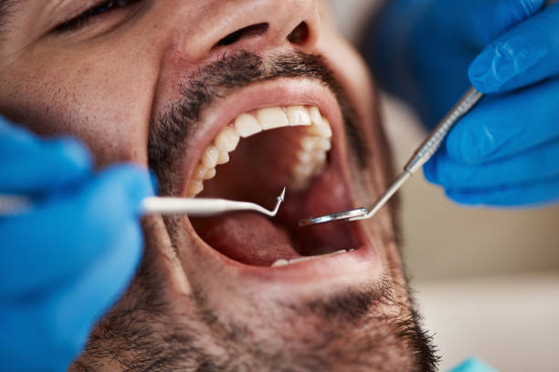 Best Emergency Treatment for Toothache in New Madison, OH